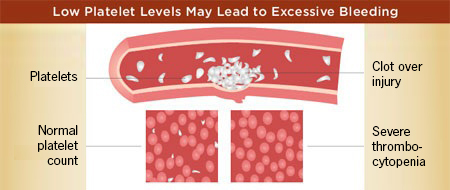 Low Platelet Levels May Lead to Excessive Bleeding