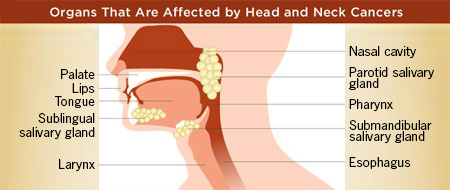 Organs affected by head and neck cancer